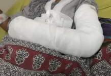 पंचकूला में ड्यूटी पर जा रही युवती सड़क हादसे में घायल, बाइक की टक्कर से हाथ-पांव में फ्रैक्चर