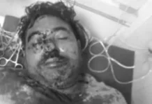 पानीपत में दुकानदार पर चाकू से हमला: एडवांस किराए के विवाद में सिर और गर्दन पर वार, हालत गंभीर