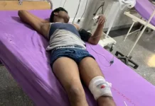 बैरिकेड तोड़कर भाग रहे संदिग्ध से पुलिस की भिड़ंत, मुठभेड़ के बाद एक घायल Police Encounter