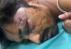 गुरुग्राम में लिफ्ट रुकने पर बवाल, ऑपरेटर पर हमला; गंभीर हालत में AIIMS रेफर Gurugram News