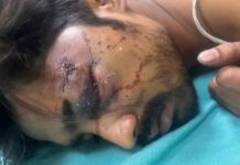 गुरुग्राम में लिफ्ट रुकने पर बवाल, ऑपरेटर पर हमला; गंभीर हालत में AIIMS रेफर Gurugram News