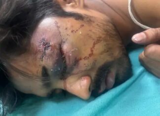 गुरुग्राम में लिफ्ट रुकने पर बवाल, ऑपरेटर पर हमला; गंभीर हालत में AIIMS रेफर Gurugram News