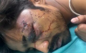 गुरुग्राम में लिफ्ट रुकने पर बवाल, ऑपरेटर पर हमला; गंभीर हालत में AIIMS रेफर Gurugram News