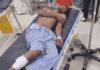 कैथल में लूटपाट के बाद भाग रहे बदमाशों से पुलिस की मुठभेड़, तीन आरोपी गिरफ्तार Kaithal Encounter