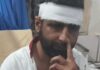 रेवाड़ी में होटल संचालक पर हमला, विरोध करने पर कर्मचारी को भी बनाया निशाना Rewari News