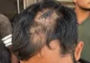 जगतपुरा में खूनी झड़प से दहशत, कई लोगों पर हमला करने का आरोप Mohali Crime