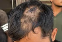 जगतपुरा में खूनी झड़प से दहशत, कई लोगों पर हमला करने का आरोप Mohali Crime