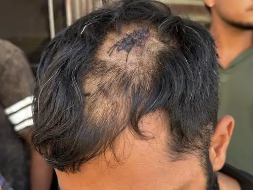 Mohali Crime