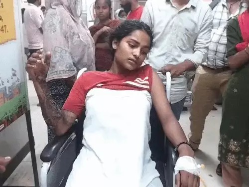Girl Burn Injury