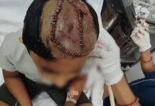 रेवाड़ी में स्कूल वैन की चपेट में आई छात्रा, 50 मीटर तक घसीटी; हालत गंभीर, जयपुर रेफर Rewari News