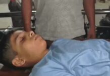 फरीदाबाद में 7वीं के छात्र पर पिटबुल का हमला, शरीर पर कई जगह काटने के निशान; पुलिस ने शुरू की जांच Faridabad Pitbull Attack