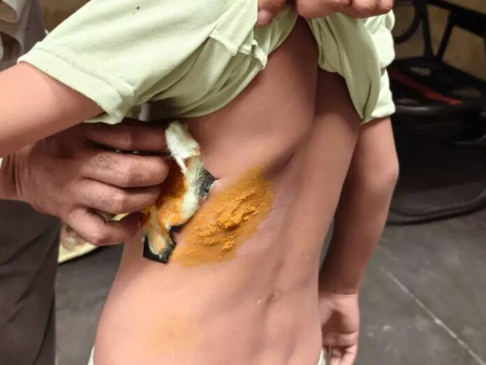 Panchkula Dog Attack