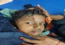 अंबाला में कुत्तों के झुंड ने 9 वर्षीय बच्चे पर किया हमला, गंभीर हालत में PGI रेफर Ambala News